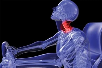 Cervical Collar Neck Brace Indications03 Cervical Collar Neck Brace Indications03